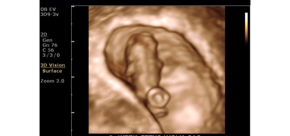 Philips ClearVue 650