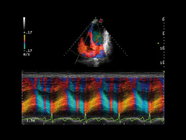 Esaote MyLab Class C