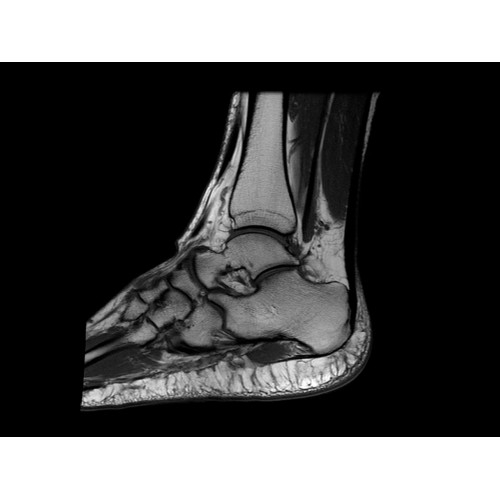 МРТ аппарат GE SIGNA Explorer 1.5T