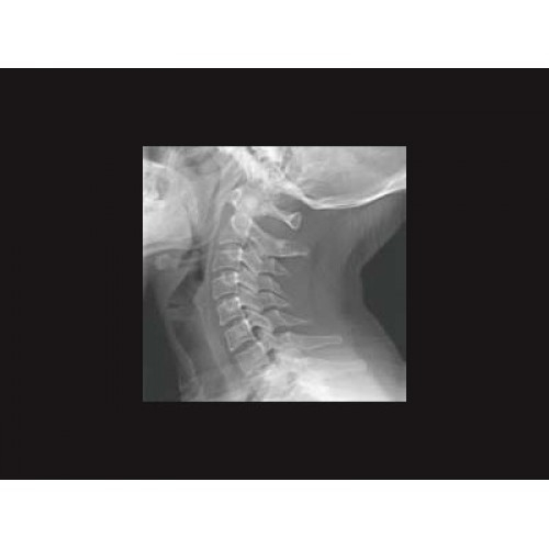 Цифровой рентген аппарат GE Brivo XR575